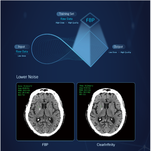 CT Scanners Supplier